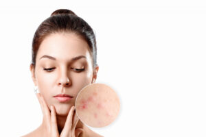 skin hospital in beeramguda